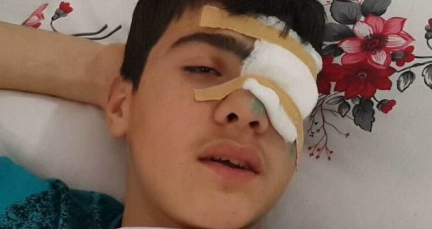  Bakıda 10-cu sinif şagirdi gözündən güllələndi – FOTO