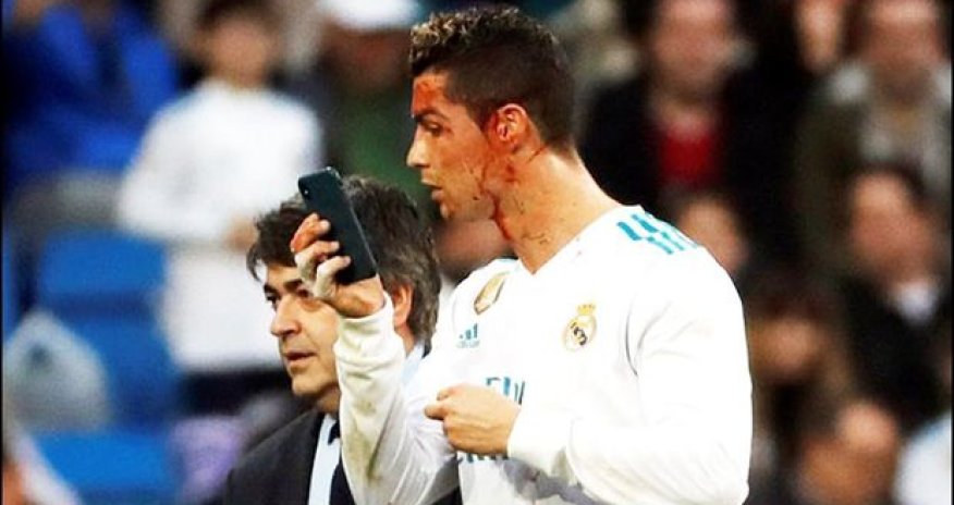 Ronaldo tanınmaz hala düşüb