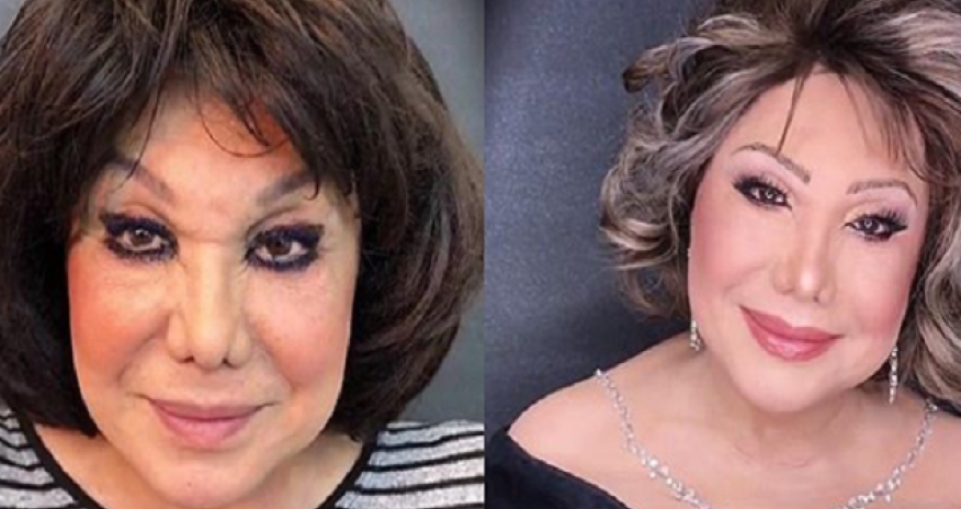 Flora Kərimova 30 yaş cavanlaşdı - FOTO