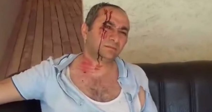 Abşeronda döyülən əlil evini yandırdı – VİDEO