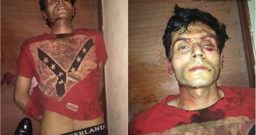 Nazirlik Yunis Səfərovun necə xəsarət aldığını açıqladı 