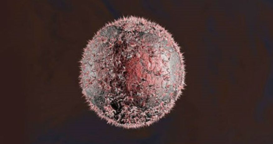 Alimlərdən xərçəngin müalicəsində yeni kəşf