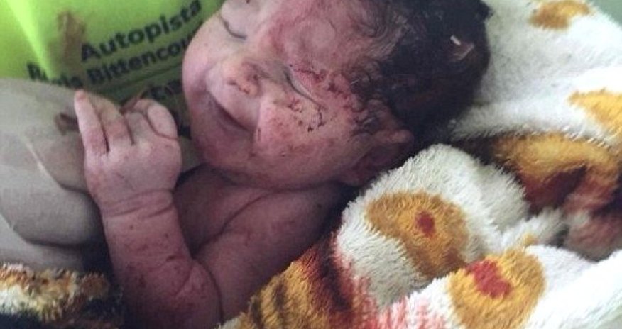 Dəhşətli yol qəzası: Körpə anasının bətnindən çıxdı - VİDEO