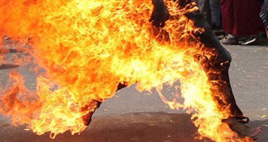 Azərbaycanda universitet müəllimi ÖZÜNÜ YANDIRDI