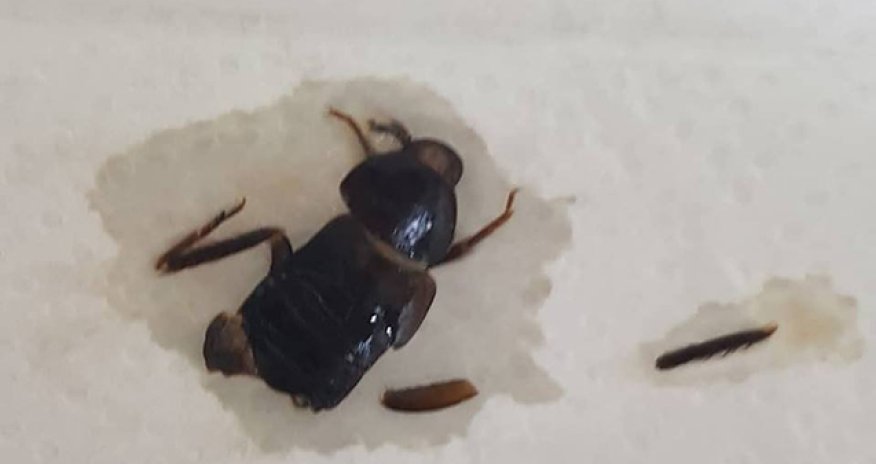 Bakıda qadının uşaqlıq yolundan bu həşarat çıxdı