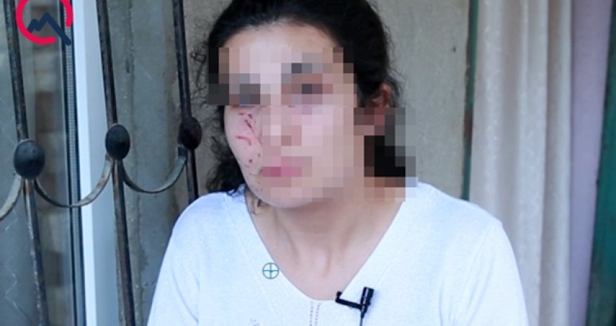 Bakıda zorlanmadan son anda qurtarılan qadın danışdı - VIDEO