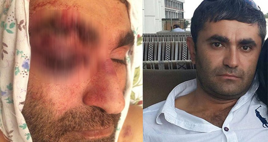 Polis idarəsindəki ölümlə bağlı daha bir - VIDEO