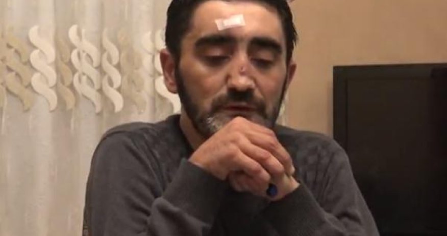 Aydın Xırdalanlının son halı – Video