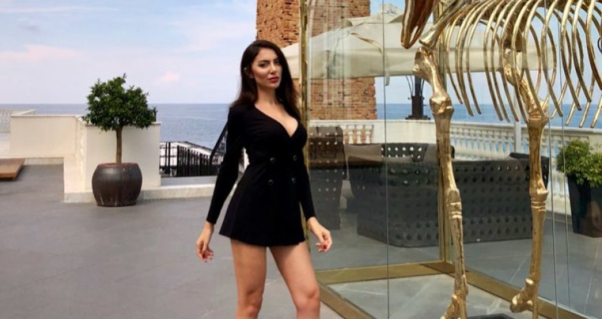 Gənc model  özünü Cenniferə oxşatdı