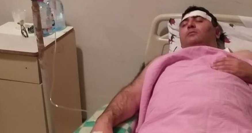 Отец избитого директора: У моего сына сильные боли