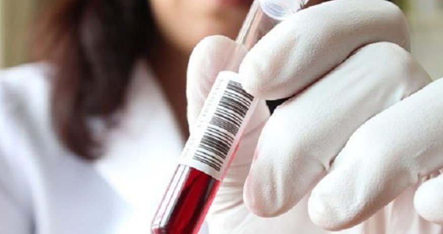 Daha bir məşhur idmançımız yarışlardan kənarlaşdırıldı