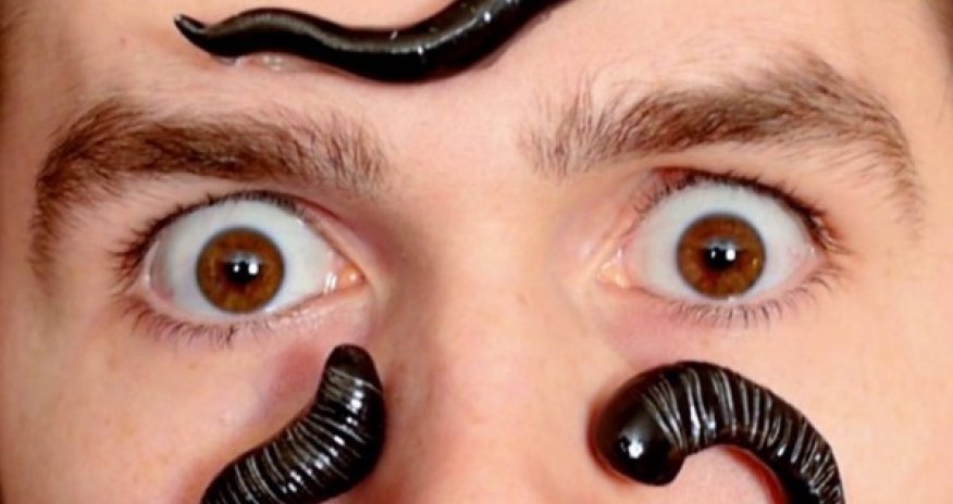 Azərbaycanda yeni zəlilər peydə oldu