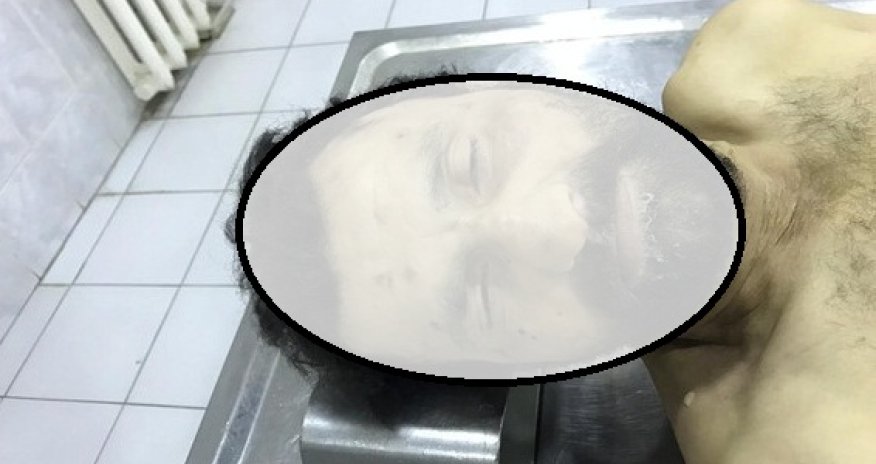 Nazirlik bu şəxslə bağlı əhaliyə müraciət etdi – FOTO 18+