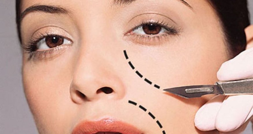 Почему в Азербайджане растет популярность пластических операций? – ВИДЕО