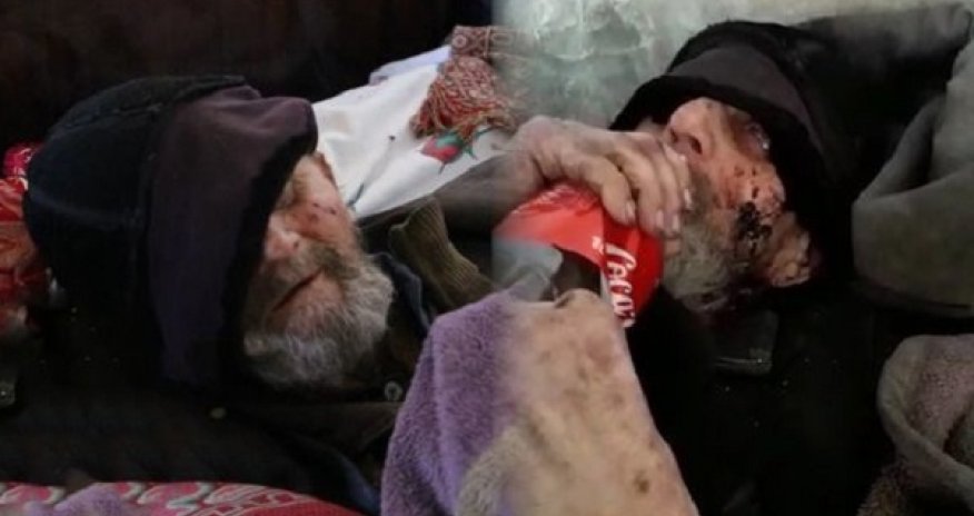 Bakıda gözləri görməyən kimsəsiz qocanın üzünü siçovullar yedi - VİDEO