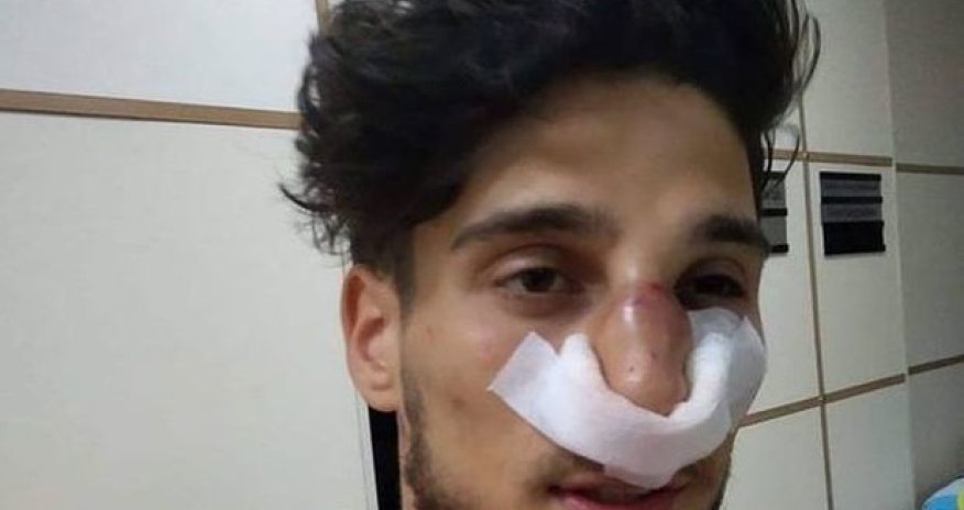 Махир Мадатов сломал нос вратарю «Кешля» - ФОТО/ВИДЕО