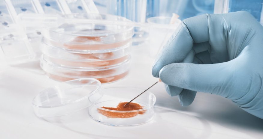 IV International Banking Forum to be held in Baku