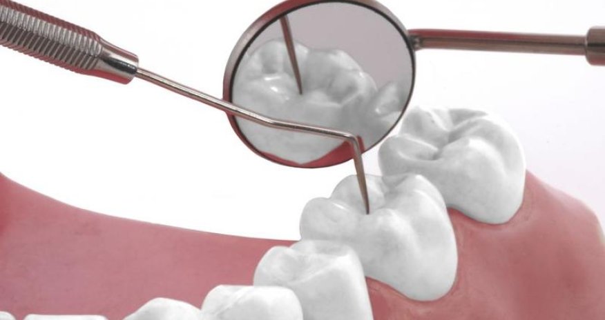 Bakıda inanılmaz hadisə - Dişini çəkdirərkən öldü