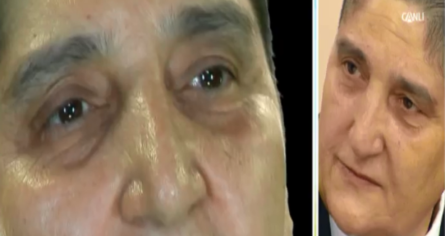 Ardıcıl 4 ailə üzvünü itirən xalq artistimiz XƏSTƏLİYƏ TUTULUB 