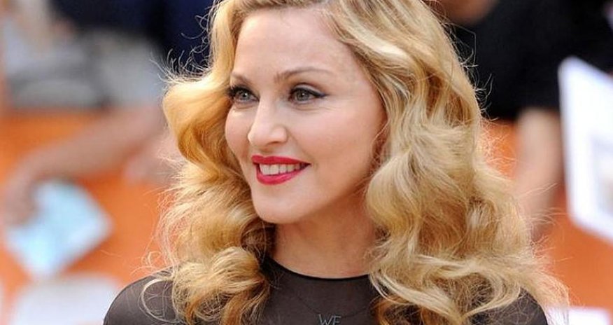 Madonna konsertini təxirə saldı - Dizi zədələnib