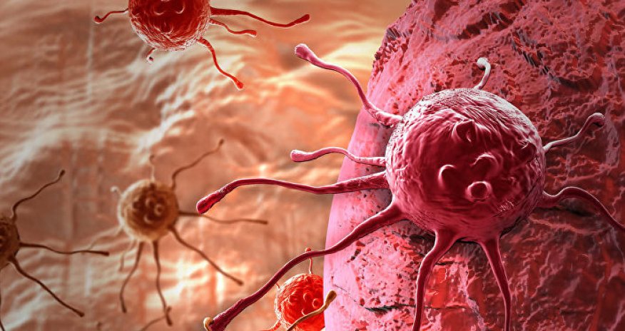 Xərçəng xəstəliyindən əziyyət çəkən tanınmış aktrisamızın SON HALI - FOTO