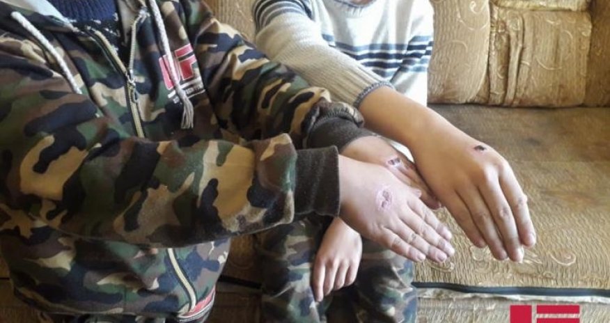 Azərbaycanda ana uşaqlarına işgəncə verib: 
