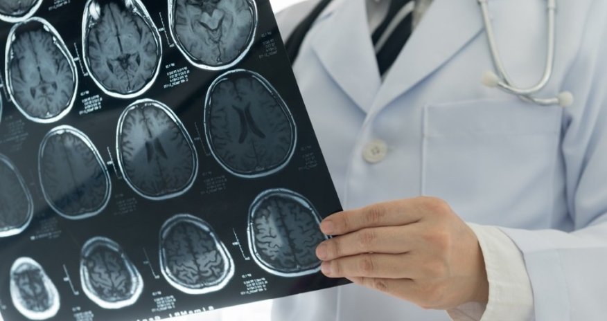 Названы первые признаки инсульта у взрослых и детей