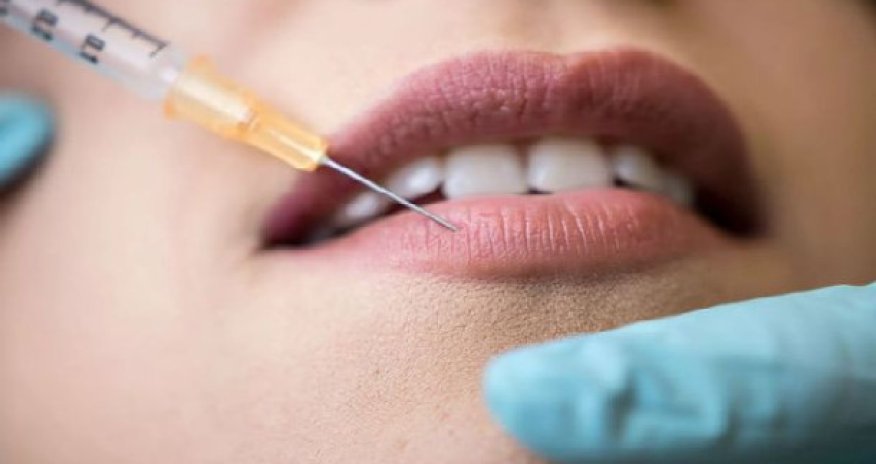 Azərbaycanda dodaqlarına dolğu vurduran qadının başına bəla gəldi - FOTO