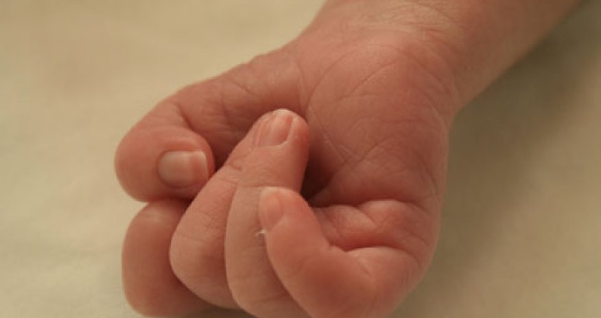 Bakıda doğulan qorxunc uşaqla balı baş ginekoloqdan açıqlama: Həkim cinayət edib