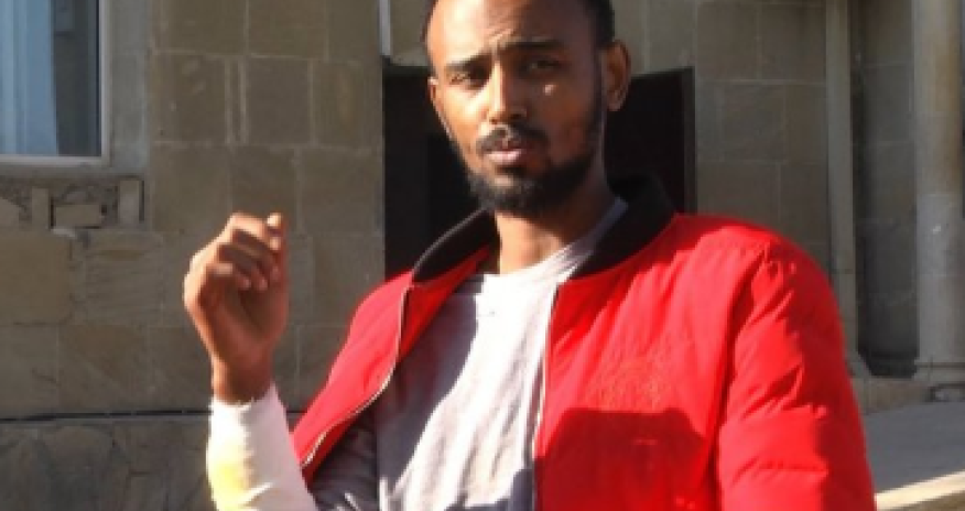 Bu da sevgilisinə görə bıçaqlanan Xose Berbardonun qardaşı - SON HALI - FOTO