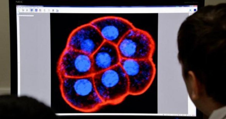 Названа причина болезни Паркинсона