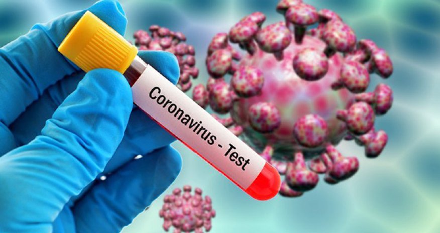 Türkiyədə böyük bir şəhərdə xeyli virus daşıyıcısı olduğu bildirildi - VİDEO