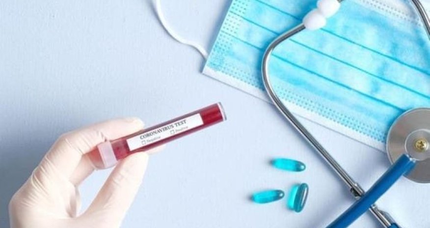 Naxçıvanda 18 nəfərdə koronavirus aşkarlandı