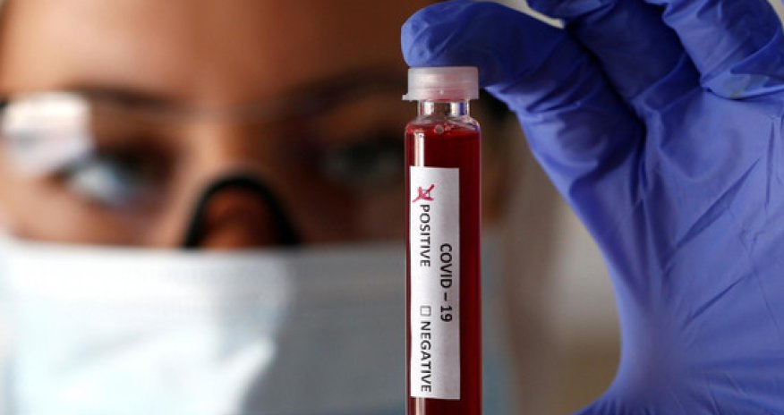 Ermənistan koronavirusun yayılmasının nəzarətdən çıxdığını açıqladı