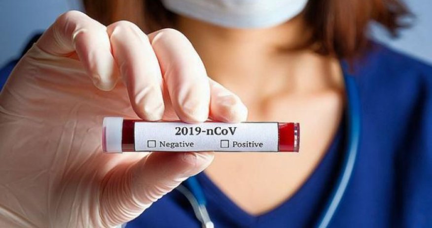 Koronavirusa qarşı dərman sınaqları ölümlə nəticələndi - testlər dayandırıldı