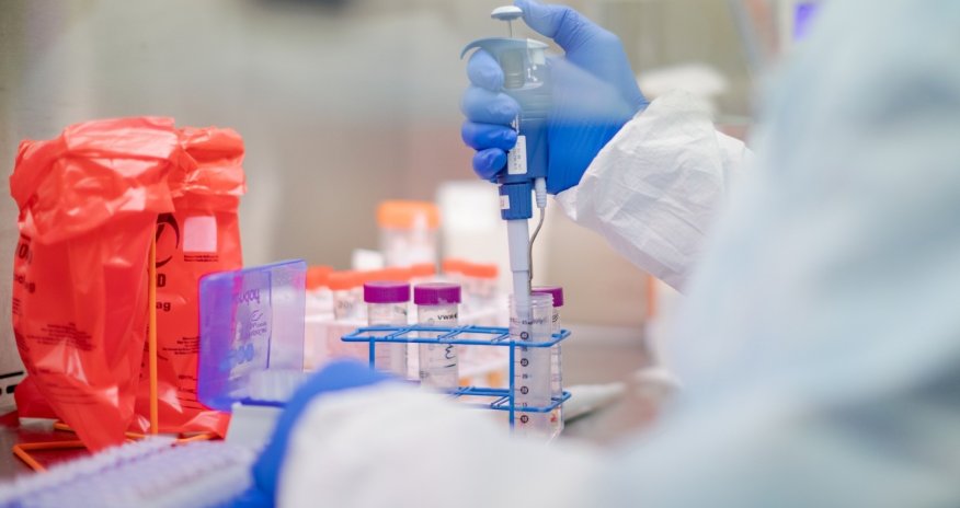 Azərbaycanda daha 38 nəfər koronavirusa yoluxub