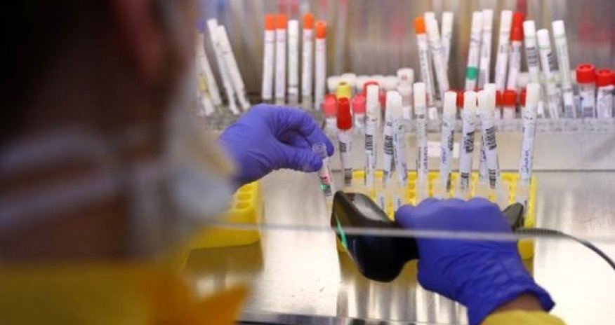 ÜST dərmanla bağlı yaydığı hesabatı “səhv” olduğu üçün sildi