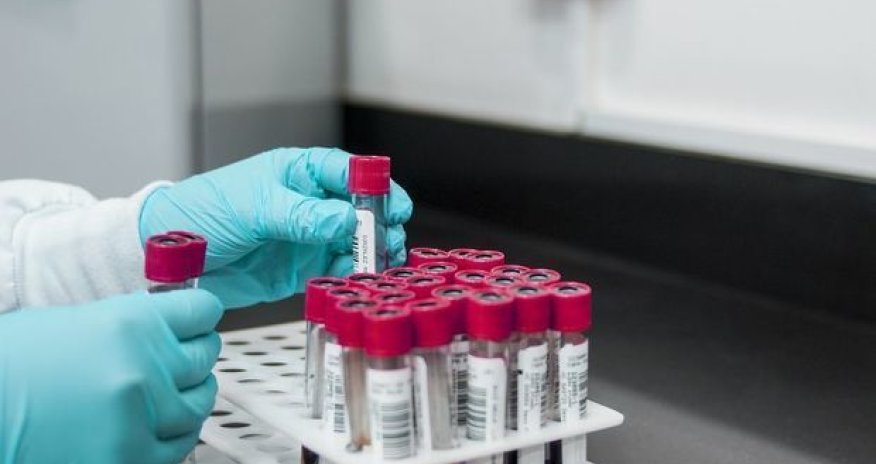 Azərbaycanda daha 65 nəfər koronavirusdan sağaldı - RƏSMİ