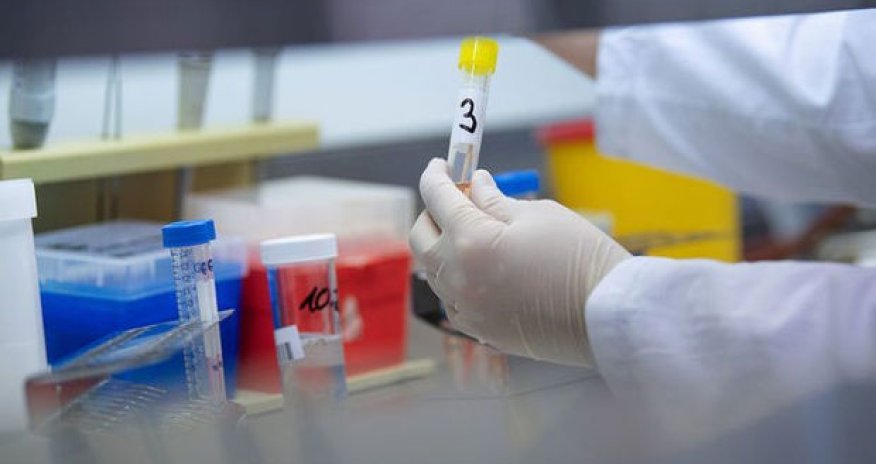 Azərbaycanda daha 39 nəfər koronavirusa yoluxdu - RƏSMİ