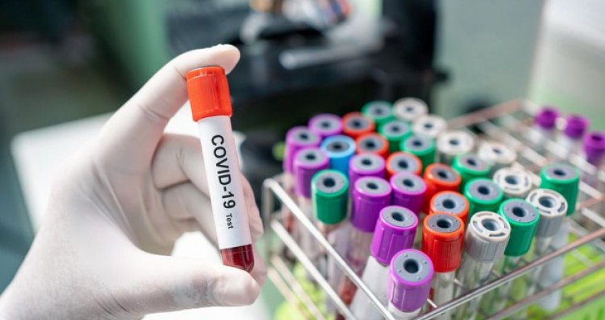 Azərbaycanda ən son koronavirus statistikası açıqlandı