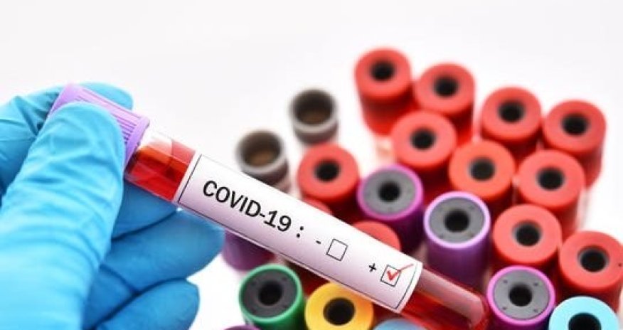 SON DƏQİQƏ: Jurnalistin ailəsində koronavirus aşkarlandı