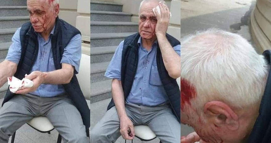 Bakıda keçmiş nazirə hücum: Başını yardılar - FOTO