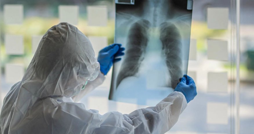 Keçmiş məmur koronavirusdan vəfat edib