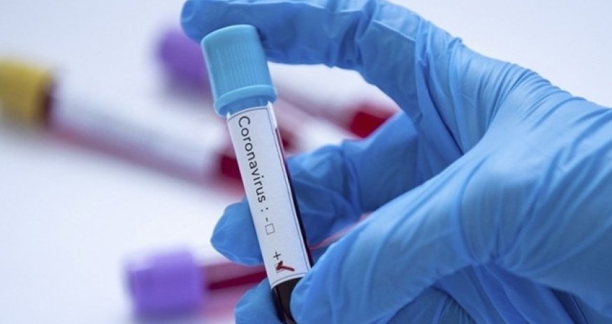 Bakıda yüksək vəzifəli şəxs koronavirusadan öldü - FOTO