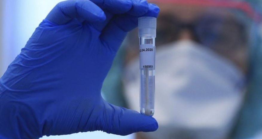 Son sutkada koronavirusdan 6 nəfər öldü