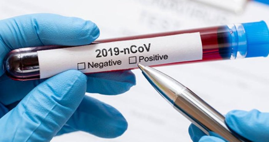 Azərbaycanda 18 jurnalist koronavirusa yoluxub - bir nəfər vəfat edib