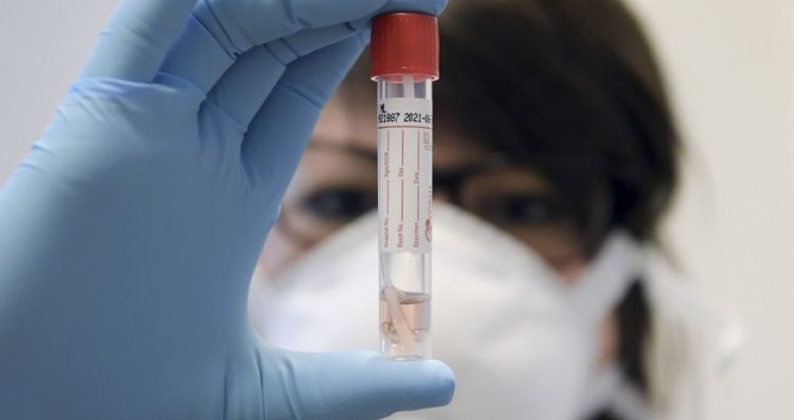 Koronavirusun insan üçün daha bir təhlükəli fəsadı məlum olub