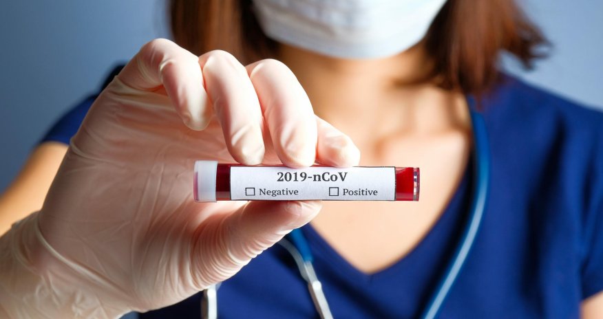 Azərbaycanda daha 493 nəfər koronavirusa yoluxub