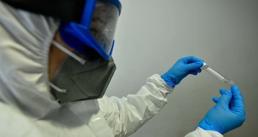 Azərbaycanda koronavirusa yoluxanların sayı açıqlanıb- SON DƏQİQƏ