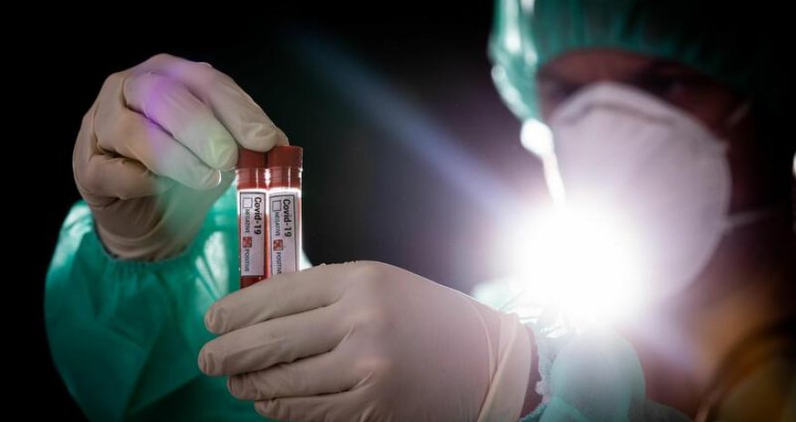 Koronavirusa yoluxanların sayı 17 milyonu keçdi